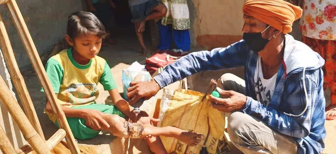 कमानसिंहका पीडा कसले उपचार गरीदेला छोरी खोजीदेला श्रीमती