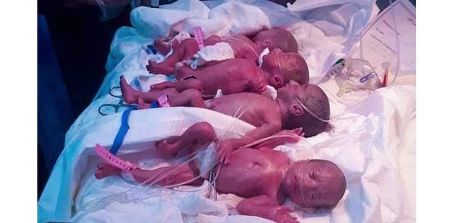 अफ्रिकी मुलुकमा एक महिलाले एकैपटक जन्माइन ९ सन्तान