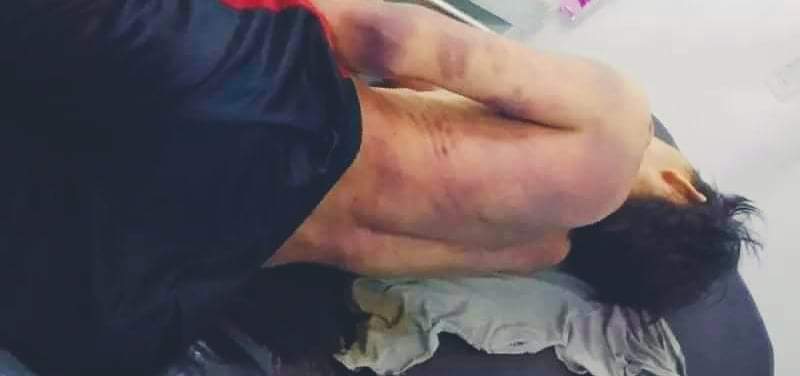 चोरीको आरोपमा प्रहरी हिरासतमा एक युवाको मृ’त्यु शरीर भरी निलदाम