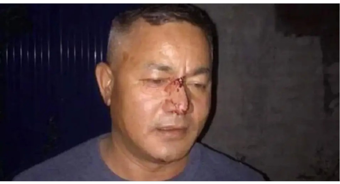 अध्यक्षमाथि आक्रमण