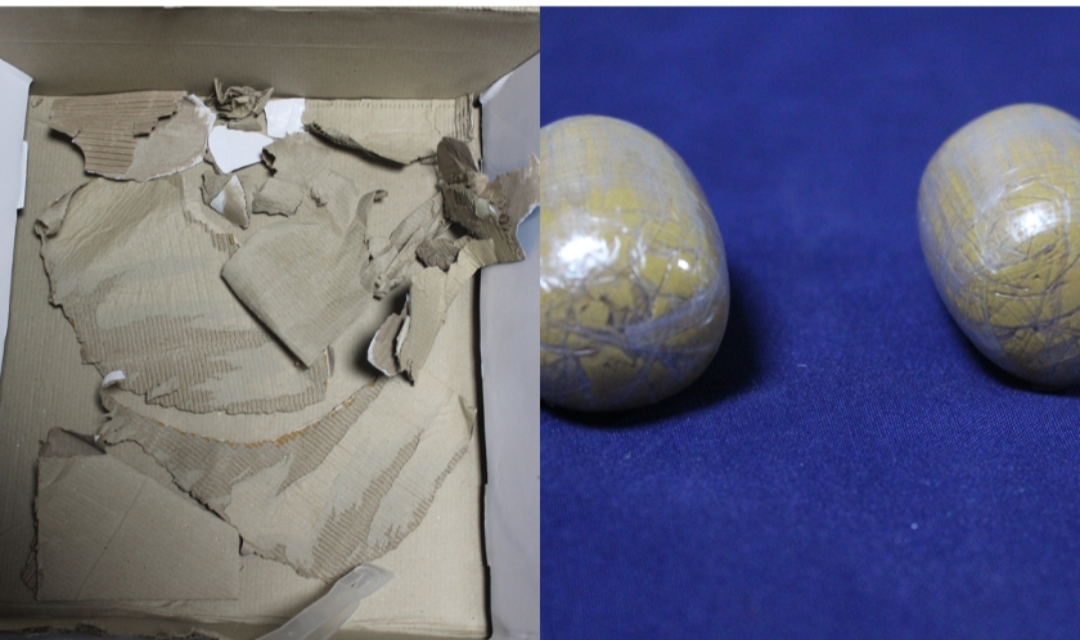 मलद्वारमा सुन लुकाएर ल्याउँदै गरेको अवस्थामा  पक्राउ