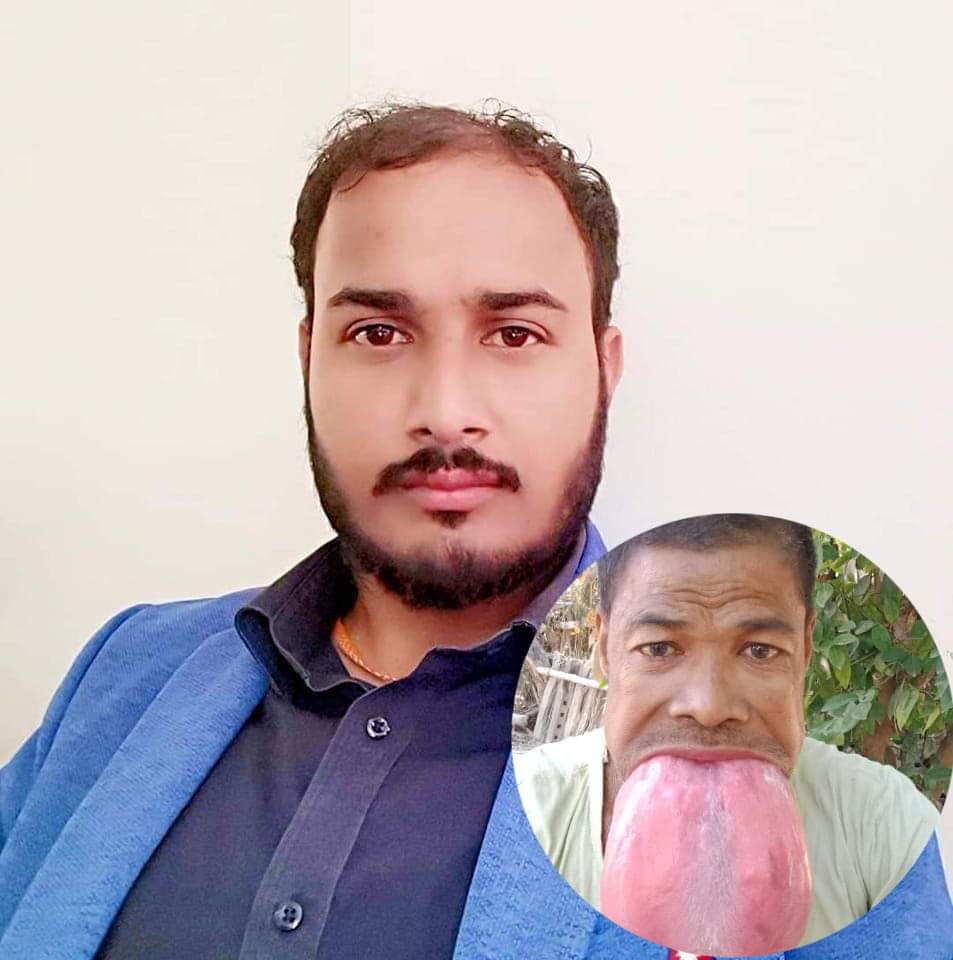 पत्रकार भावुकको पहलमा हल्लु नारायण चौधरीको जिब्रो उपचारका लागि सहयोग रकम उठ्दै