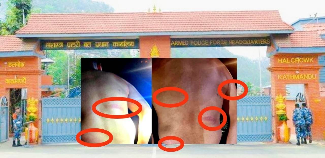 सशस्त्रका इन्स्पेक्टर राईले कानुन हातमा लिएर हवल्दार र जवानलाई घाइते हुने गरि कुटपिट