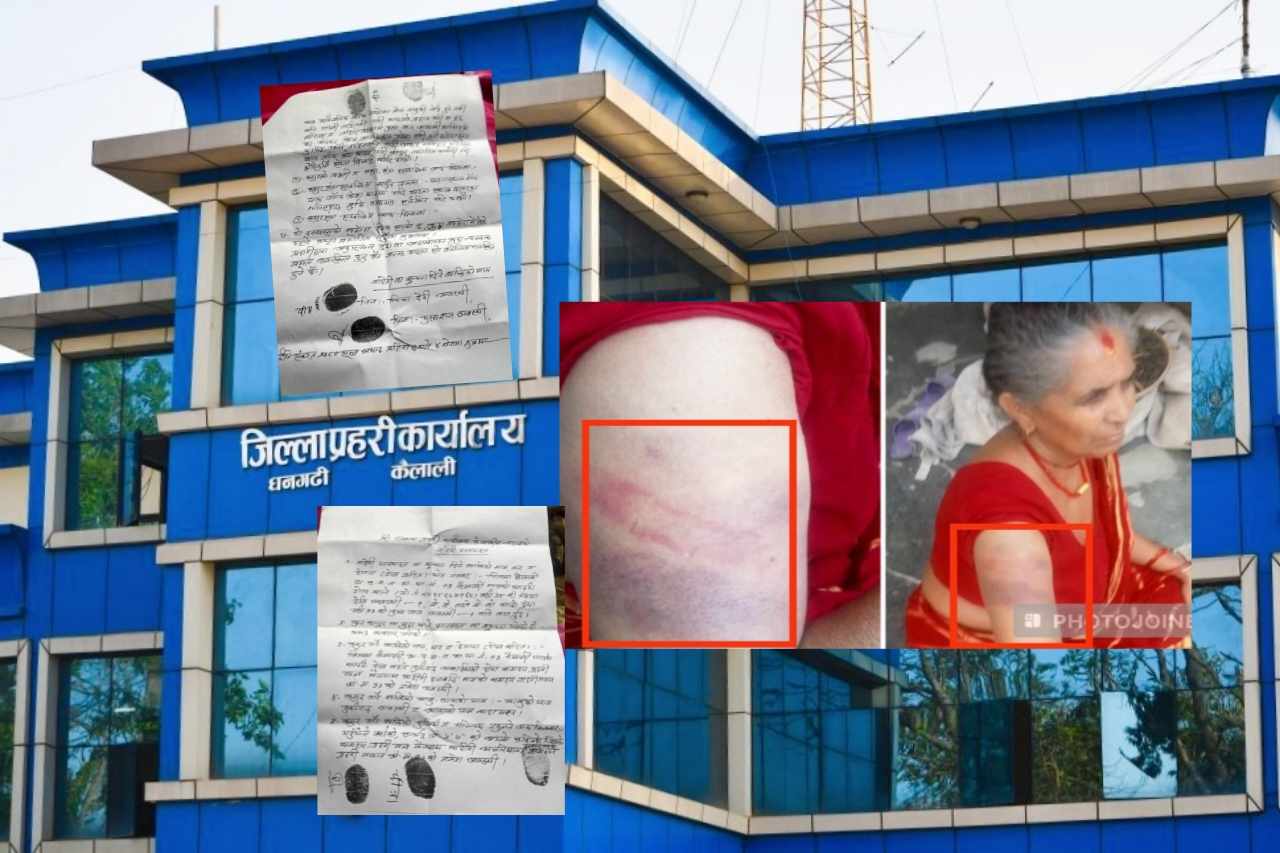 धनगढीमा सशस्त्र प्रहरीको आतंक ६० वर्षीया वृद्धलाई कुटपिट मुद्दा दर्तै गर्दैन प्रहरी किन ???