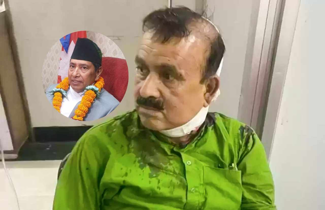 काँग्रेसले पार्टीका सहमहामन्त्री यादवमाथी आक्रमणको घटनाको गृहमन्त्री श्रेष्ठसँग जवाफ माग