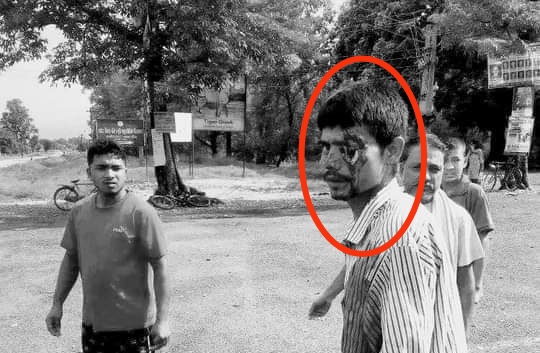 बर्दियाको जंगलमा एक ब्यक्ति च्याउ खोज्न गएको बेला बाघको आक्रमणबाट घाइते