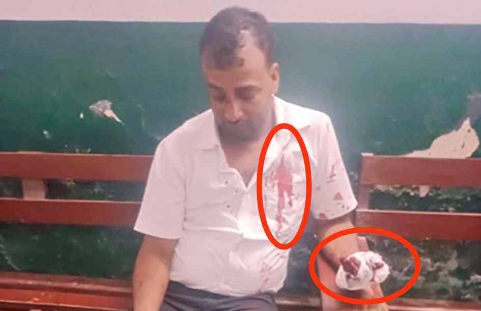 बिराटनगरमा मुन होटल तथा गीत गजलका सञ्चालक दिलिपकुमार भगतमाथि खुकुरी प्रहार