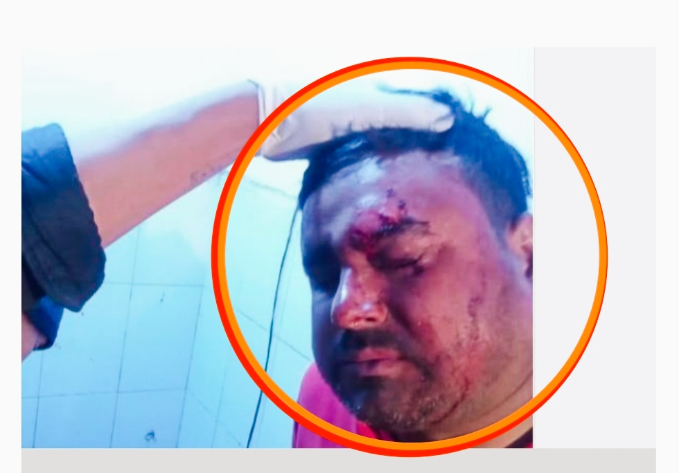 तुलसीपुरका होटल व्यवसायी आचार्यमाथि आक्रमणप्रति विभिन्न संघसंस्थाहरूद्वारा गम्भीर आपत्ति,