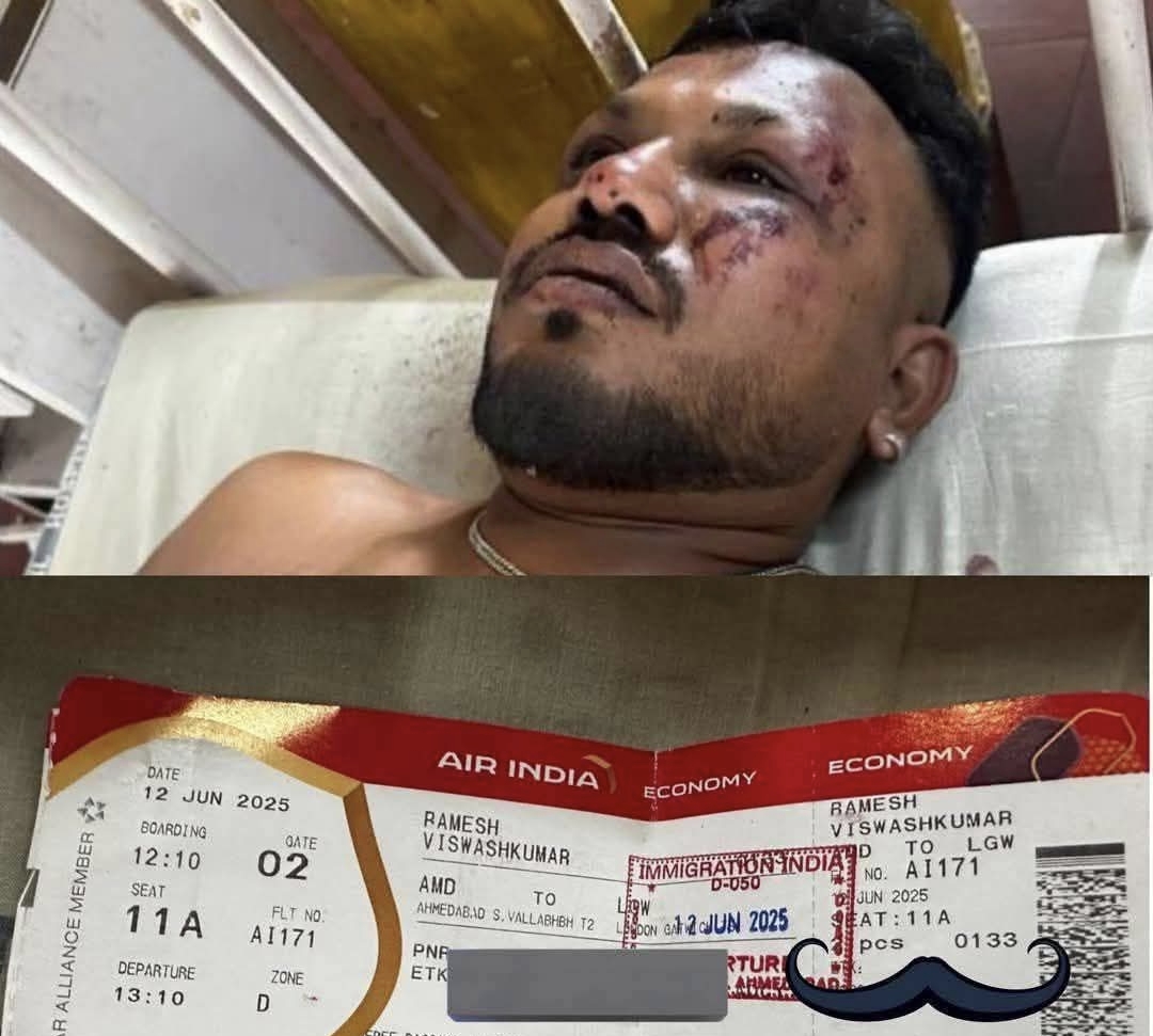 भारतको अहमदाबाद दुर्घटना ग्रस्त भएको विमानमा सवार एक व्यक्तिको जीवितै उद्धार,