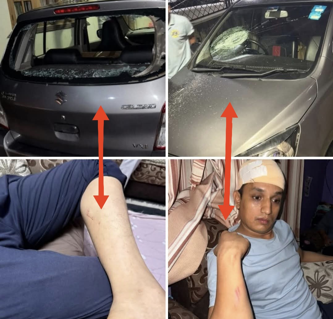 राष्ट्रिय स्वतन्त्र पार्टीका नेता बदन भण्डारीमाथि काठमाडौं कपनमा आक्रमण,