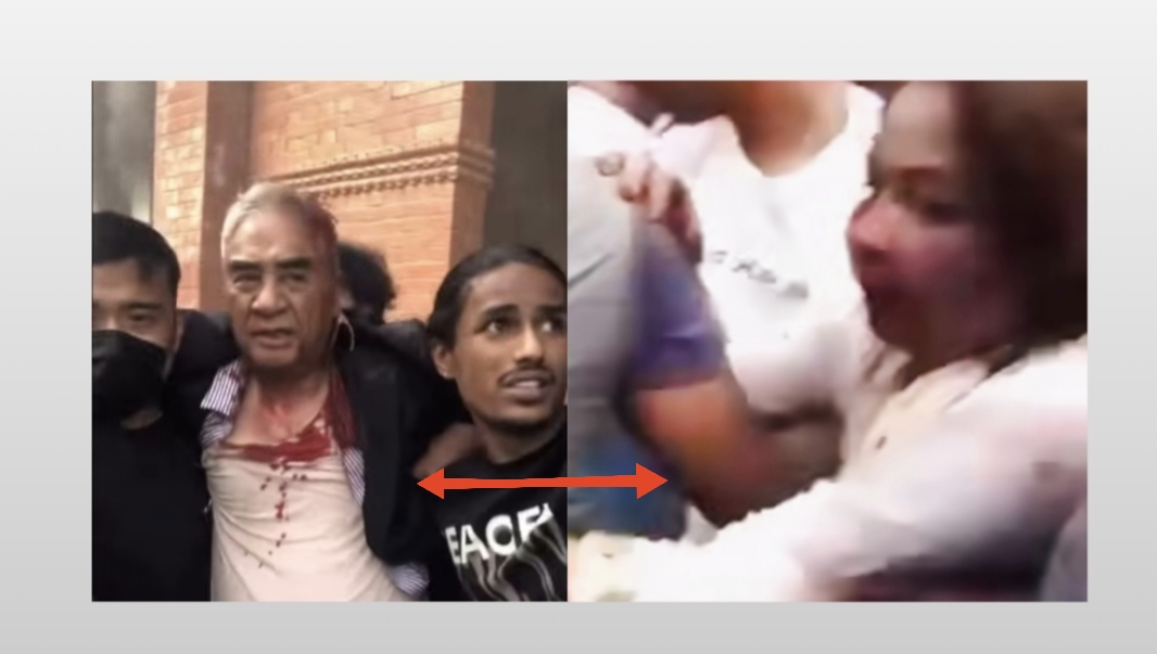 कांग्रेस सभापति शेरबहादुर देउवा र उनकी पत्नी परराष्ट्र मन्त्री आरजु राणा देउवामाथि निरघात कुटपिट