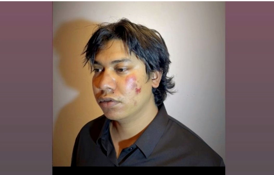 नेकपा एमाले नेताहरुमाथि व्यंग्य गर्दै भिडियो बनाएका टिकटकर अर्जुन खड्कामाथि आक्रमण,