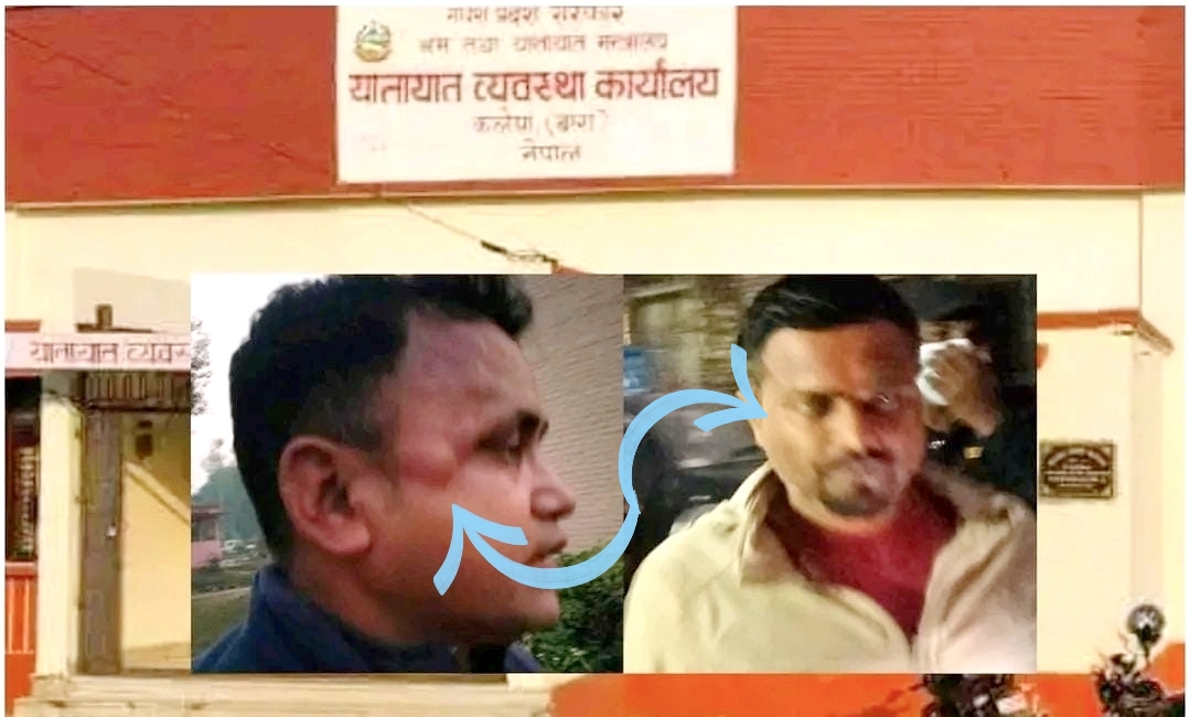 सरुवाको रिसले अन्धो बनेर बारा यातायात प्रमुख दासद्वारा खरिदार साहमाथि क्रूरतापूर्वक कुटपिट